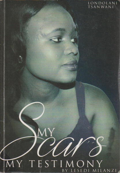 My Scars, My Testimony - Londolani Tsanwani
